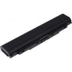 baterie pro Lenovo ThinkPad T440p/ T540p, L440, W540/ Typ 45N1145 5200mAh
